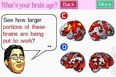 Brain Age (DS) Editorial image